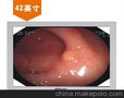 供应其他LC-MS4201EO安立信42寸内窥手术医用监视器