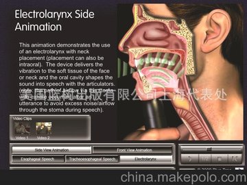 供应“喉头切除-电子喉”教育软件- 英文版